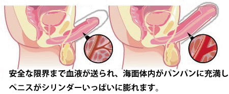 �V�g�������@����T�v���@�C���[�W�摜